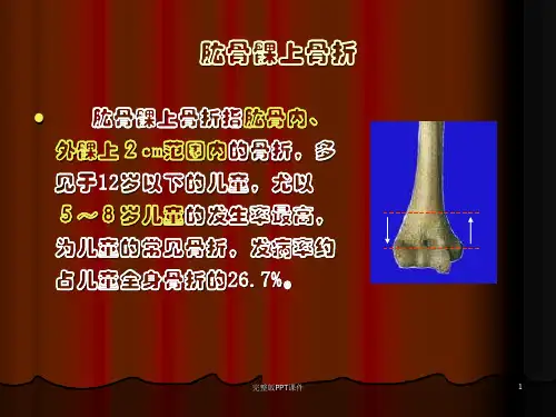 肱骨髁上骨折ppt课件
