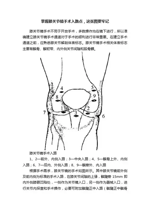 掌握膝关节镜手术入路点，这张图要牢记