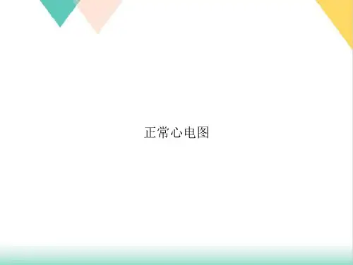 正常心电图PPT.