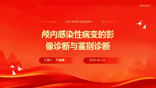 颅内感染性病变的影像诊断与鉴别诊断ppt课件