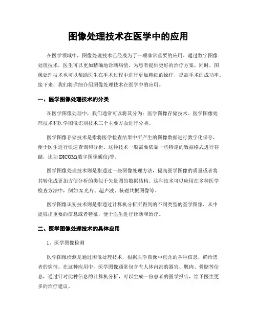 图像处理技术在医学中的应用