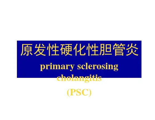原发性硬化性胆管炎