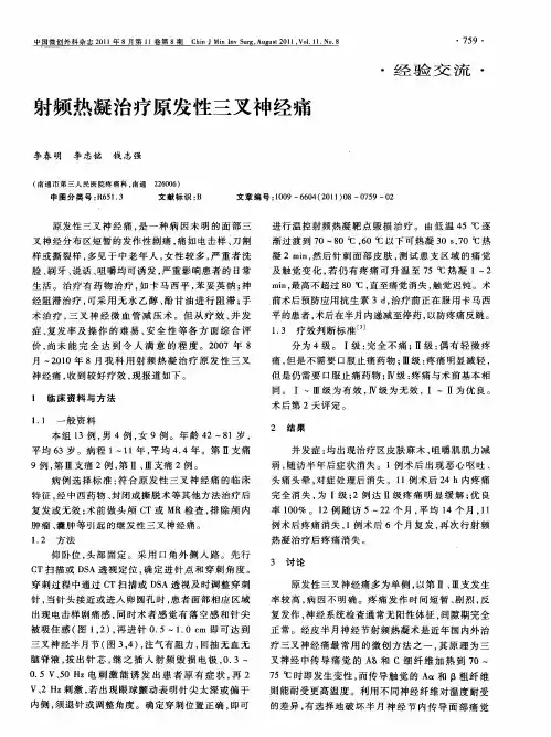 射频热凝治疗原发性三叉神经痛