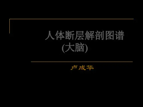 人体断层解剖图谱大脑 (2)-PPT文档资料