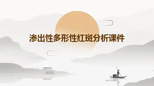 渗出性多形性红斑分析课件
