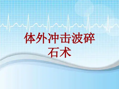手术讲解模板：体外冲击波碎石术