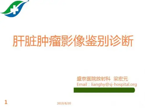 肝脏肿瘤影像学鉴别诊断ppt课件