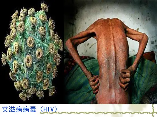 人教版高中生物 必修三2.4  免疫调节课件 (共64页)