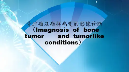 骨肿瘤及瘤样病变的影像诊断ppt课件
