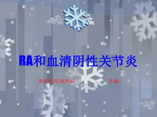 血清阴性关节炎