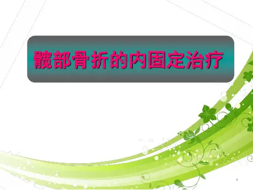 髋部骨折的内固定治疗  ppt课件