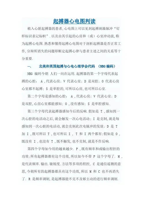起搏器心电图判读