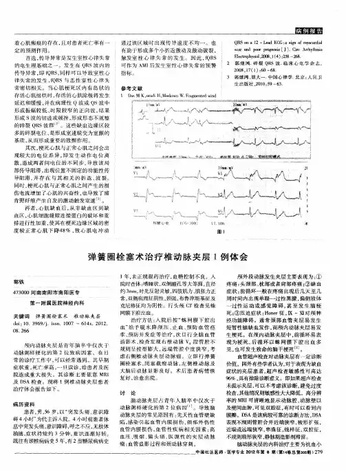 弹簧圈栓塞术治疗椎动脉夹层1例体会