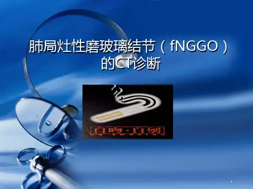 肺磨玻璃结节CT诊断PPT学习课件