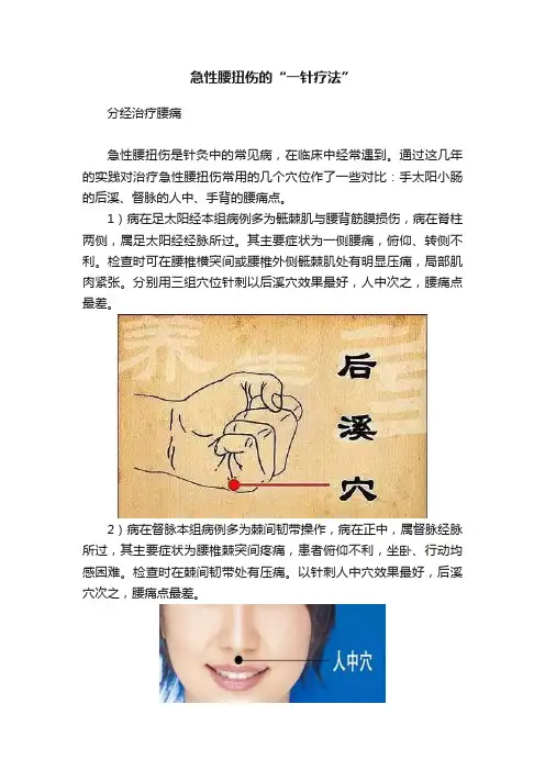 急性腰扭伤的“一针疗法”