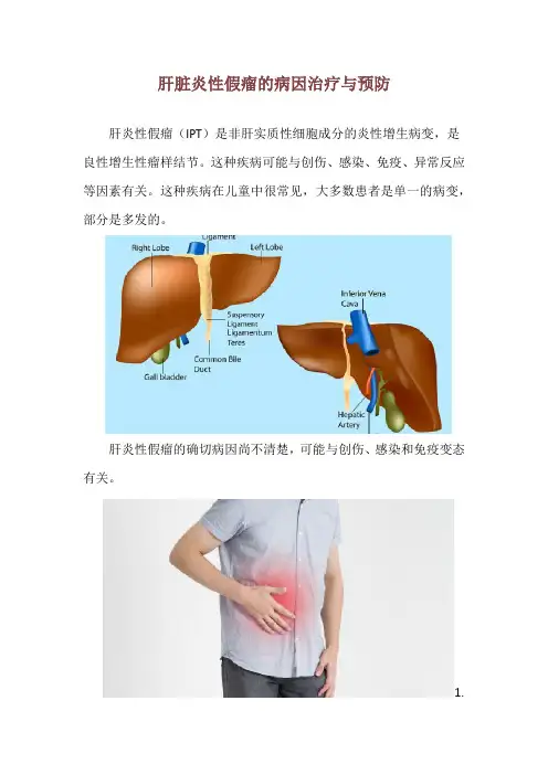 肝脏炎性假瘤的病因治疗与预防