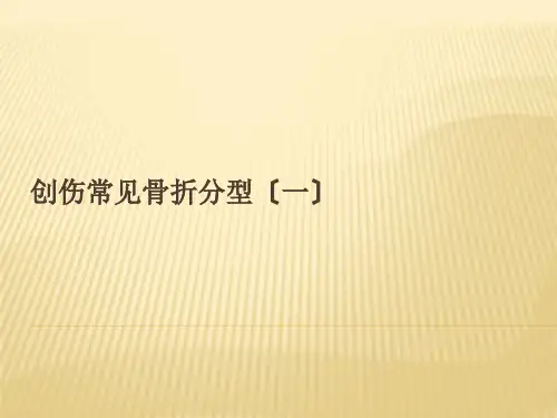 骨折AO分型课件