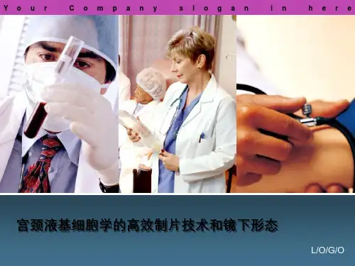 宫颈液基细胞学高效制片技术与镜下形态