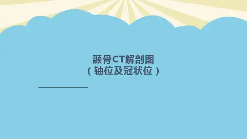 颞骨ct解剖图轴位及冠状位实用课件.2021最全PPT