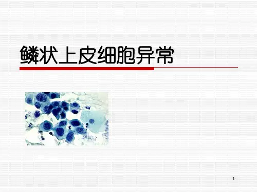 鳞状上皮细胞异常PPT参考课件