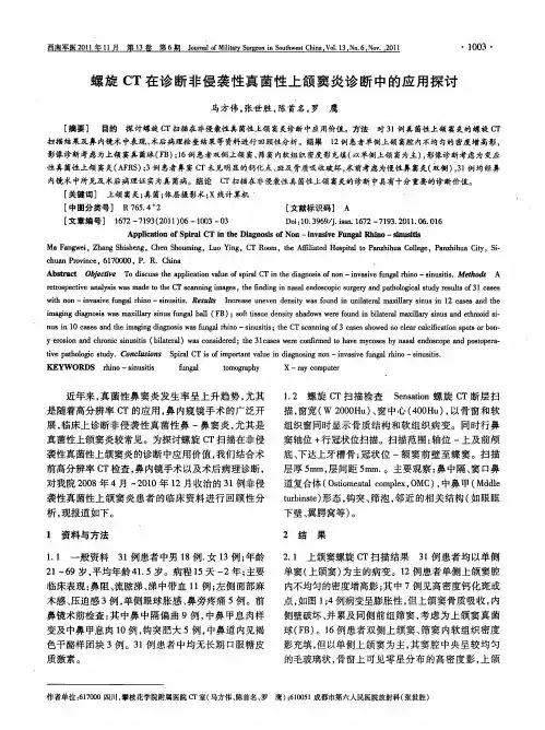 螺旋CT在诊断非侵袭性真菌性上颌窦炎诊断中的应用探讨