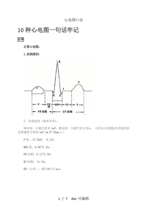 心电图口诀甄选.