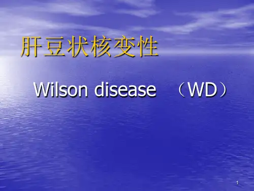 肝豆状核变性ppt课件