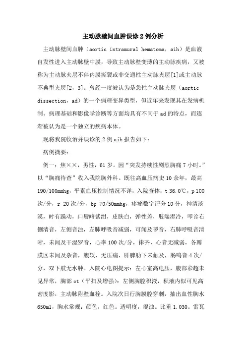 主动脉壁间血肿误诊2例分析