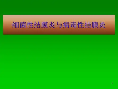 细菌性结膜炎与病毒性结膜炎的临床表现及治疗ppt课件