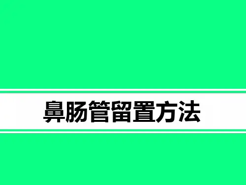 鼻肠管留置方法
