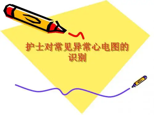 常见异常心电图的识别(护理)