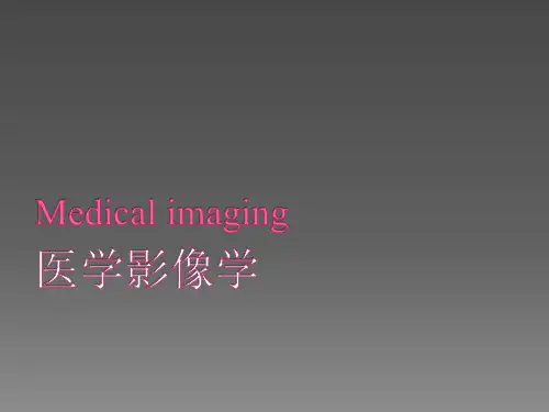 正常胸部的X线表现ppt课件