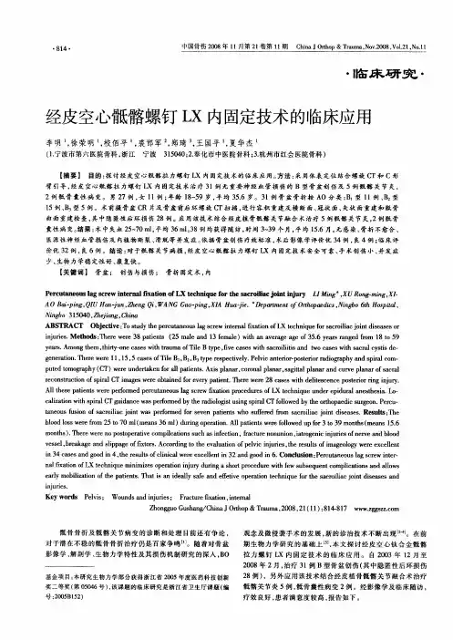 经皮空心骶髂螺钉LX内固定技术的临床应用