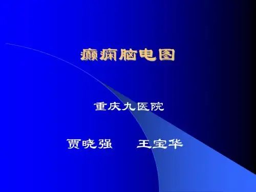 癫痫脑电图