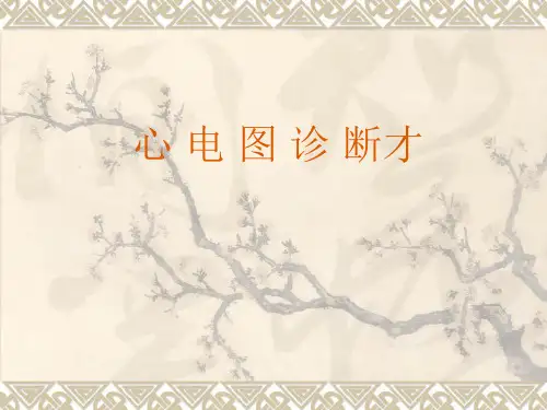 心电图_心电向量详解