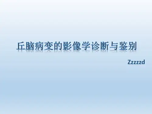 丘脑病变影像学表现