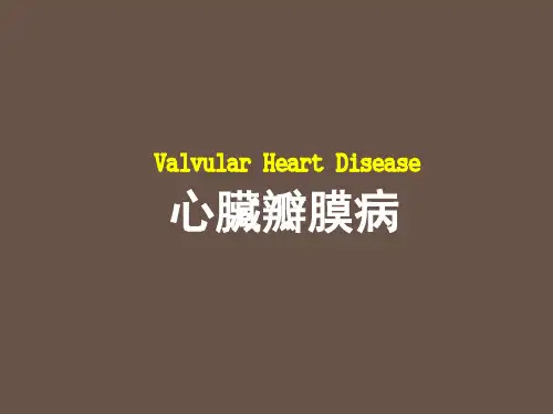 心脏瓣膜病 PPT课件