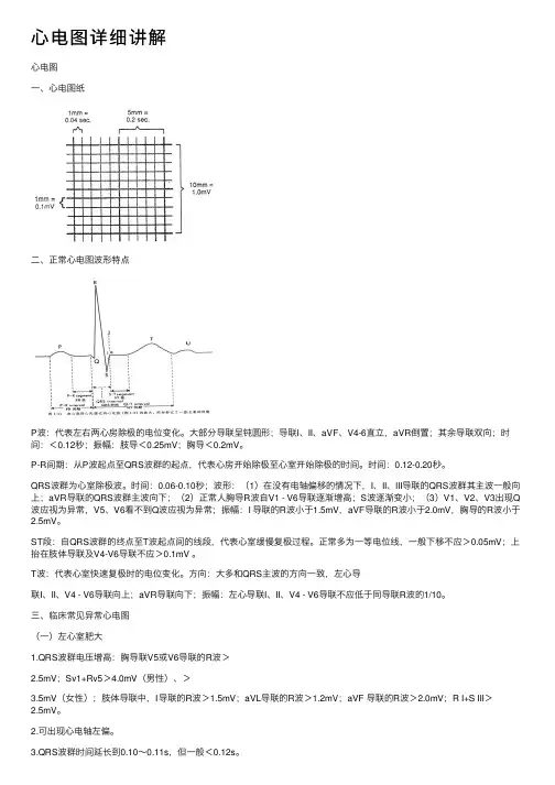 心电图详细讲解