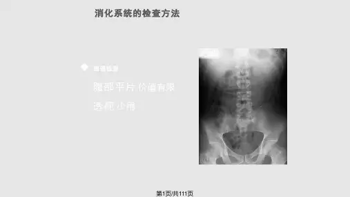 胃肠道CT检查影像PPT课件