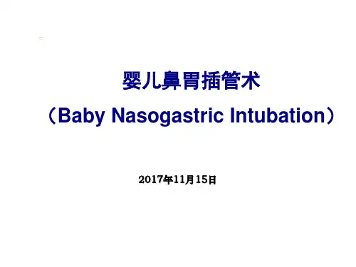 小儿胃管置入术