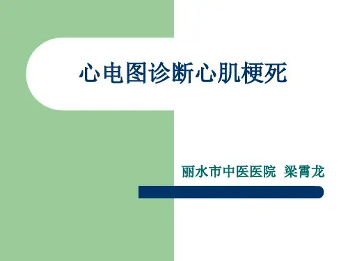 心电图诊断心肌梗死 PPT课件.ppt