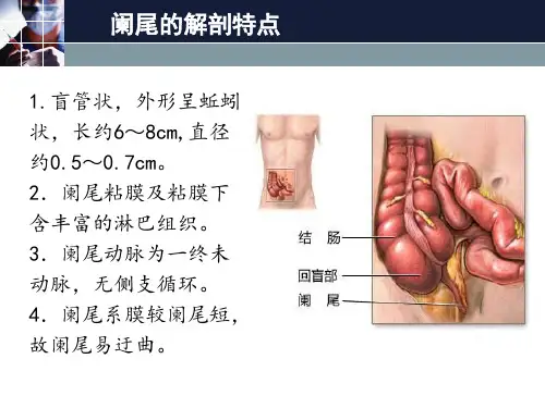 阑尾炎PPT课件.ppt