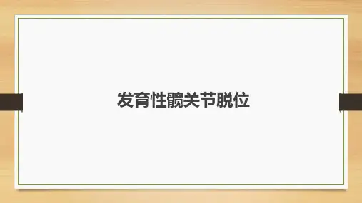 发育性髋关节脱位