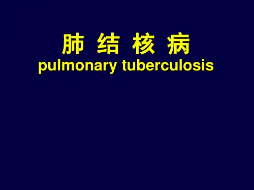 内科学第7版肺结核PPT课件