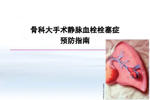 静脉血栓栓塞症预防指南PPT课件