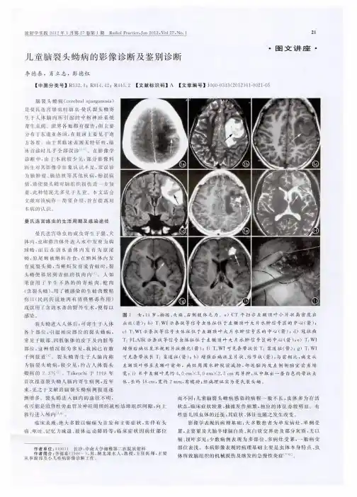 儿童脑裂头蚴病的影像诊断及鉴别诊断