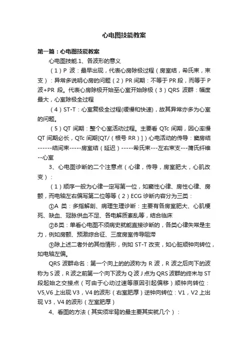 心电图技能教案