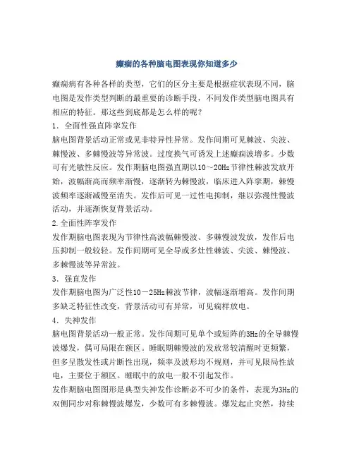 癫痫的各种脑电图表现你知道多少