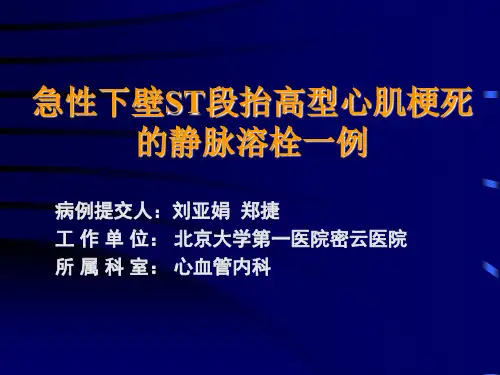 急性心肌梗塞的静脉溶栓病例分享