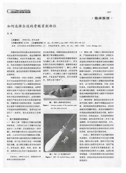 如何选择合适的骨髓穿刺部位